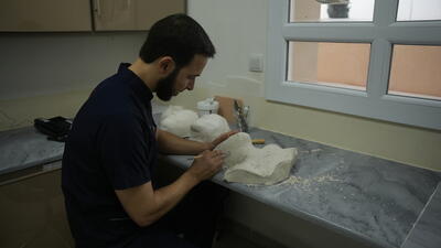 Huge needs for burns patients in Syrian camps