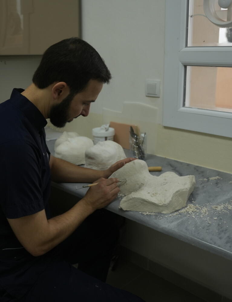 Huge needs for burns patients in Syrian camps